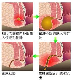 福建协和医院肛肠科