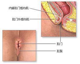 福州哪个医院可以肛裂?