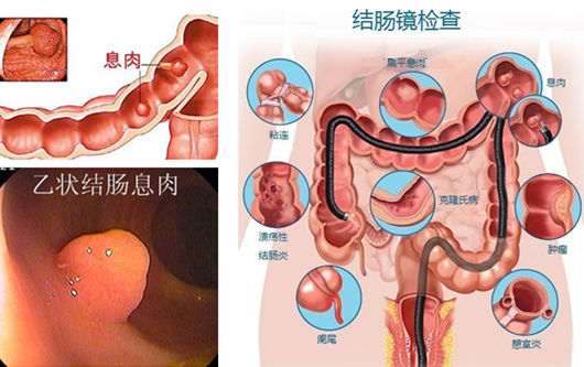 医博肛肠医院地址