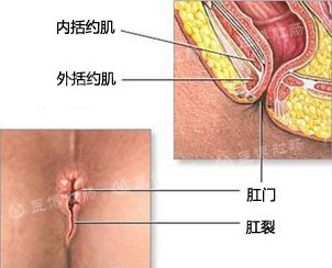 医博肛肠医院如何